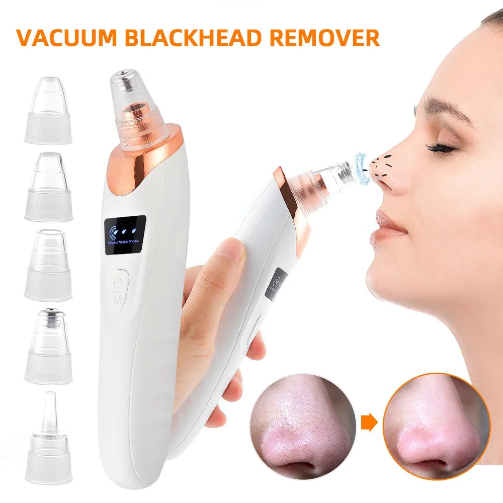 Vacuum Blackhead Remover – Deep Pore Cleansing & Skin Care