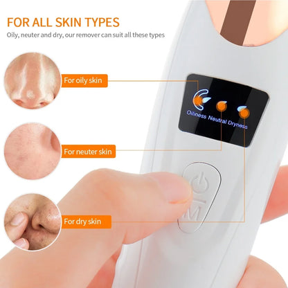 Vacuum Blackhead Remover – Deep Pore Cleansing & Skin Care